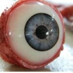 Ripped out eyeball