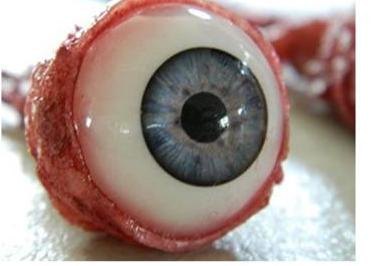 Ripped out eyeball
